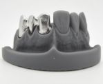 Image - Dental Devices Ready in 24 Hours Thanks to Metal 3D Printer